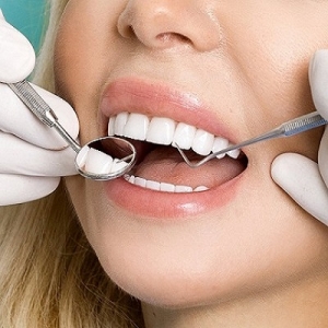 A Brighter Smile Awaits: The Magic of Dental Veneers
